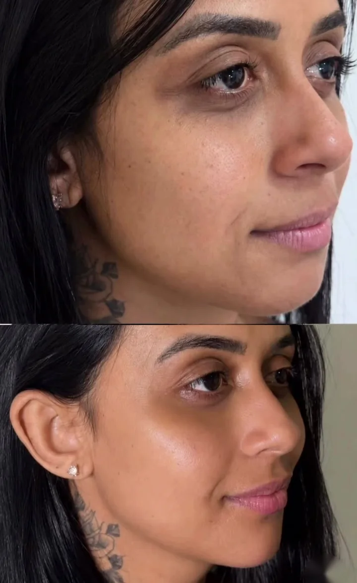 Antes e depois: RC Magic